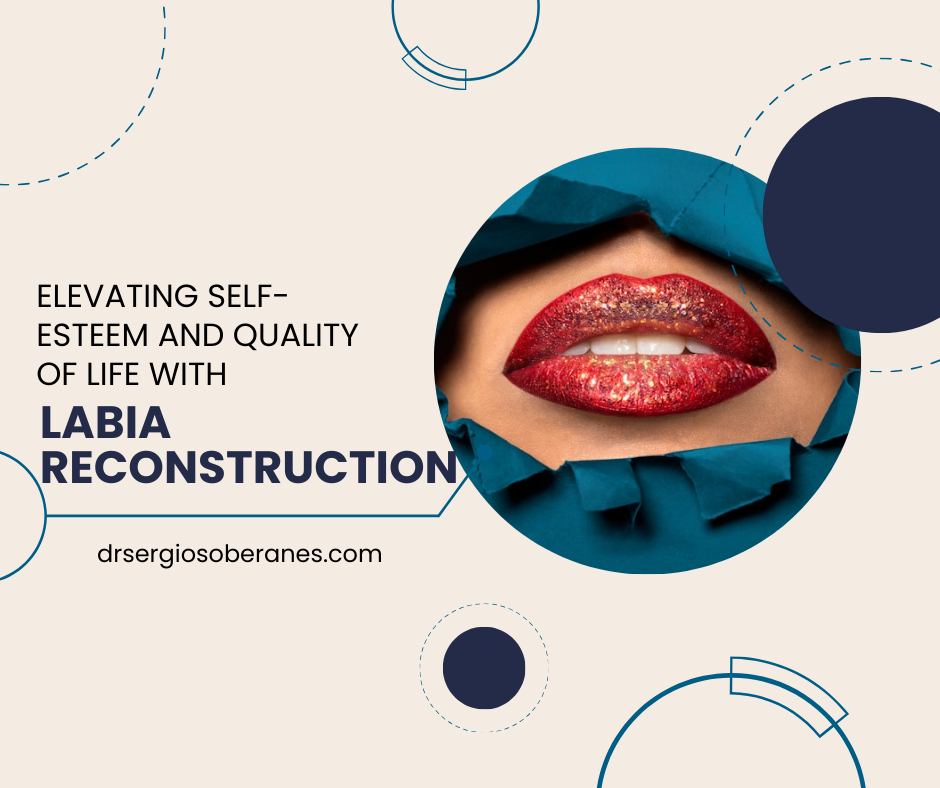 Elevating Self-Esteem and Quality of Life with Labia Reconstruction