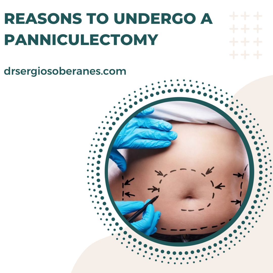 Reasons to Undergo a Panniculectomy